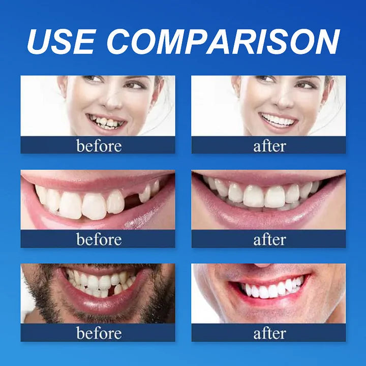 Medical Full Denture with Strong Suctiond🦷