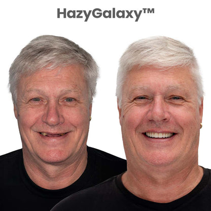 ⭐DarkFairy™ Custom-Fit Dentures ⏰ ENDS TODAY   70% OFF | Smile with Confidence